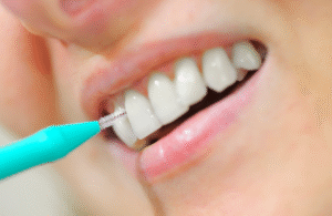 Dental floss and Interdental brushes Guide