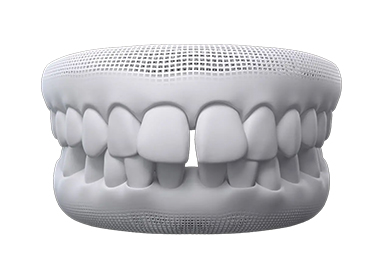 teeth-thumb02