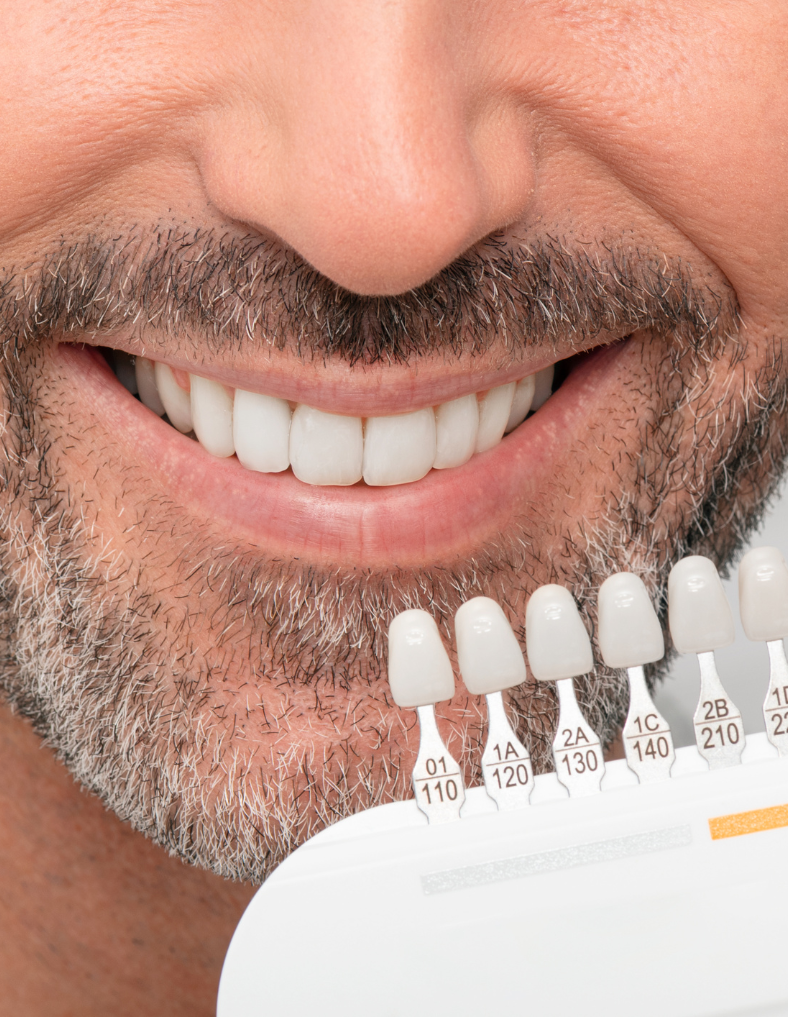 tooth WHITENING