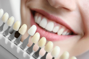 tooth whitening