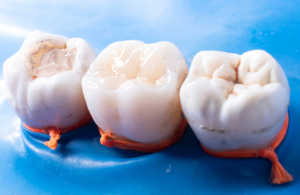 Composite fillings