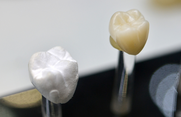 Dental Crown