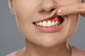 Periodontics