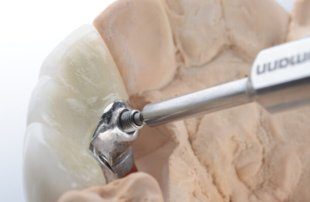 Abbey Mead Dental & Implant Clinic