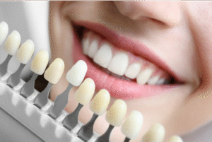 Tooth Whitening