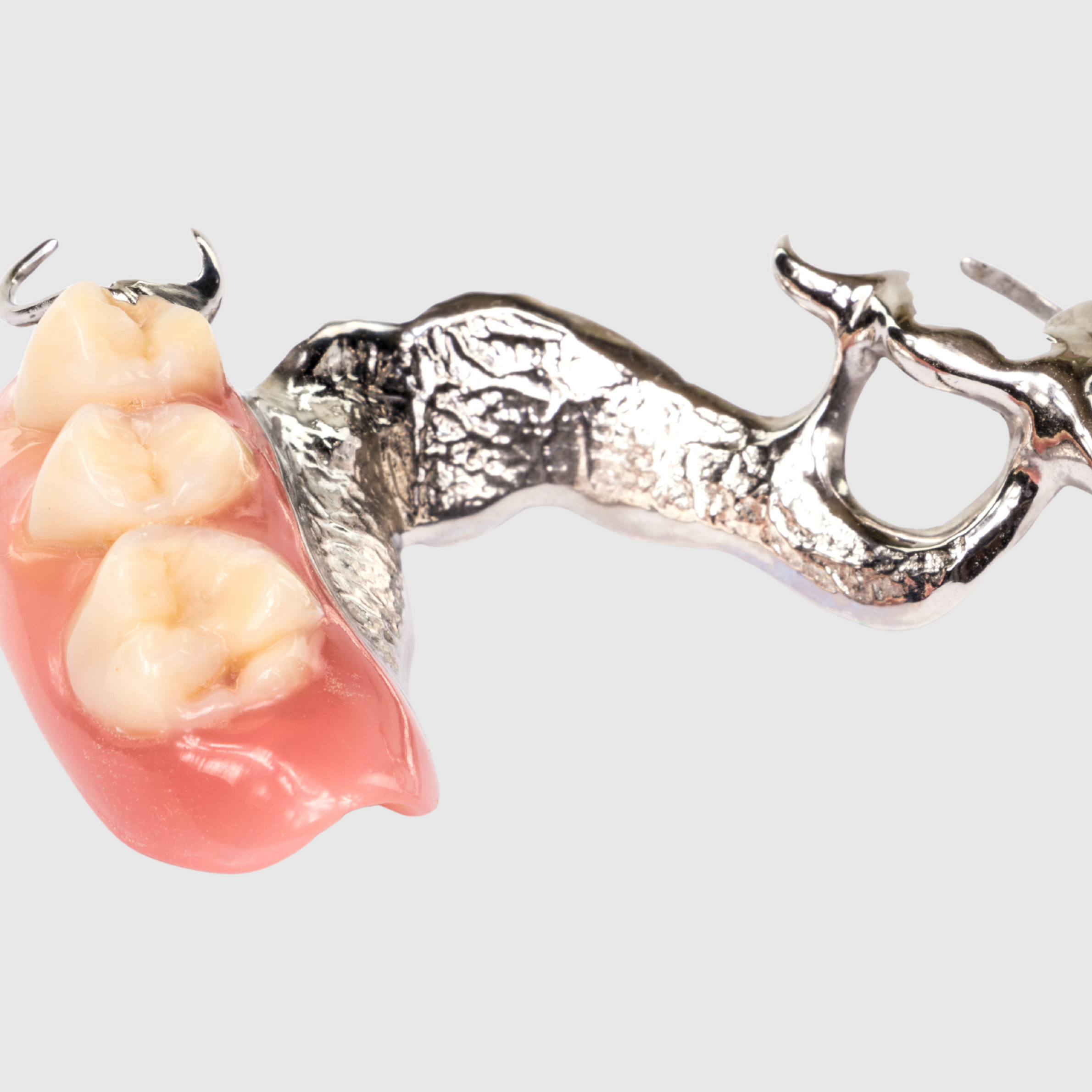 Partial Chrome Denture
