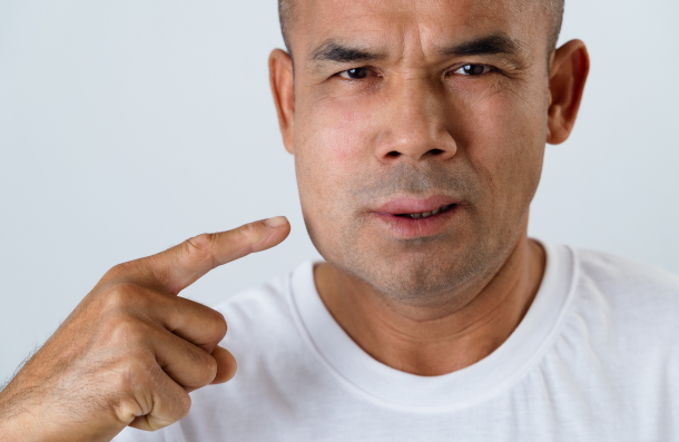Man with facial swelling dental emergency