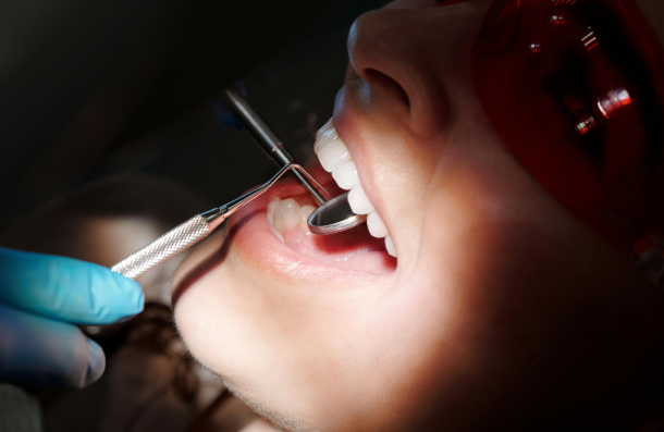Wisdom teeth exam