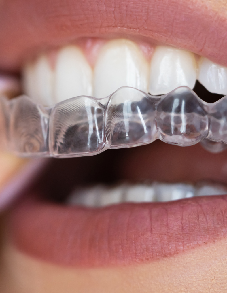 Treatment - Abbey Mead Dental & Implant Clinic