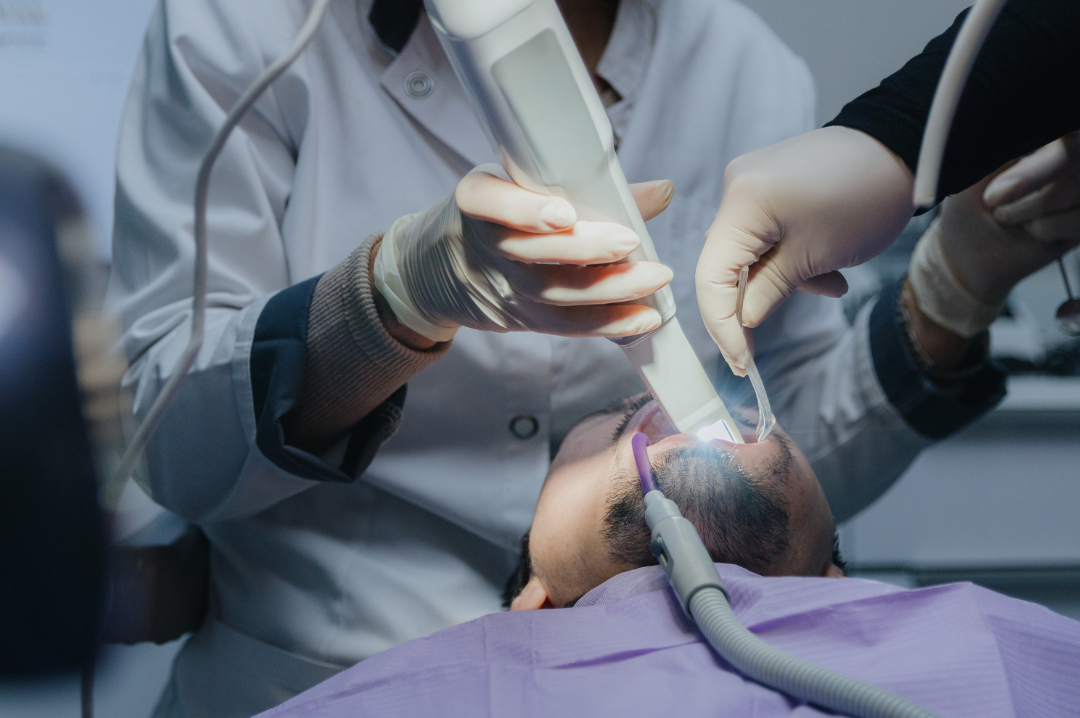 Dental intra oral scan