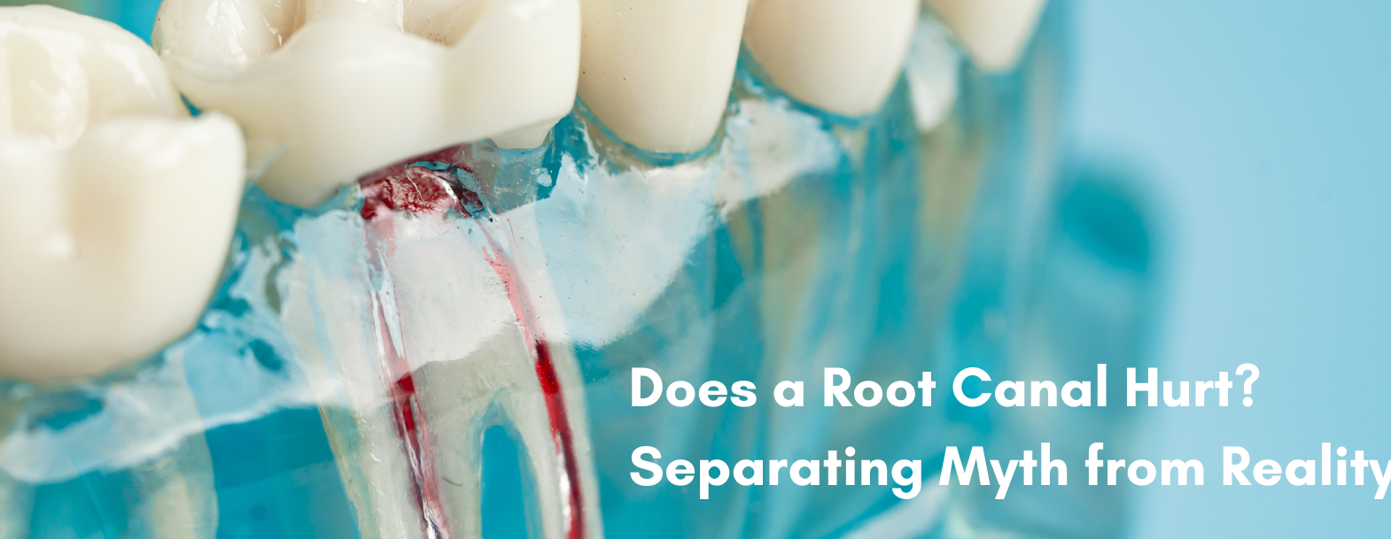 AM blog banner does RCT hurt