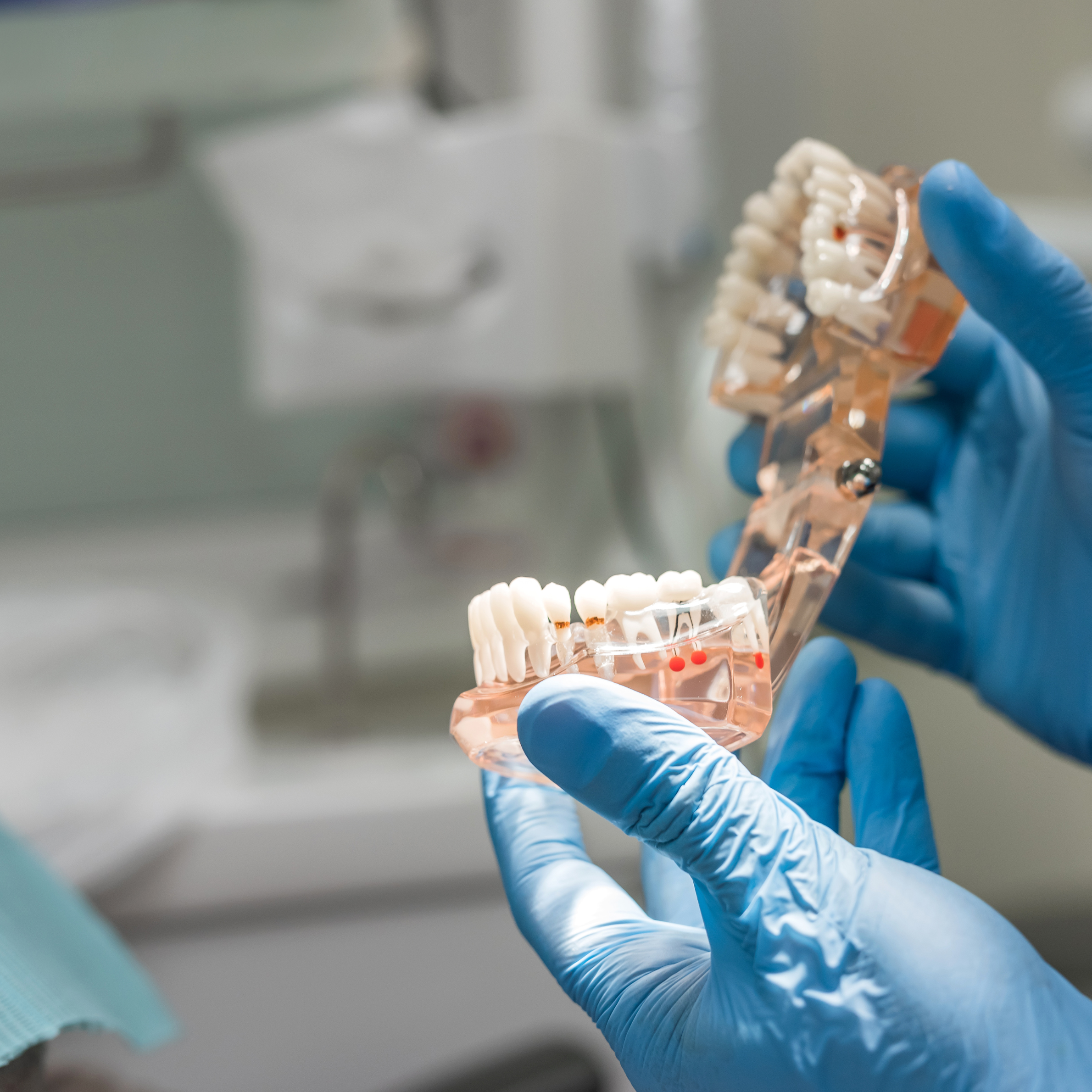 root CANAL ON A MODEL