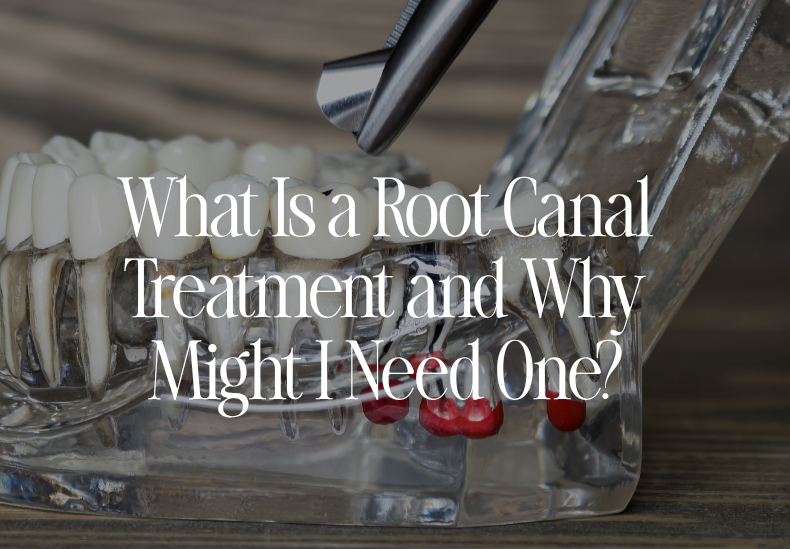 What is a root canal, abbey mead Tavistock